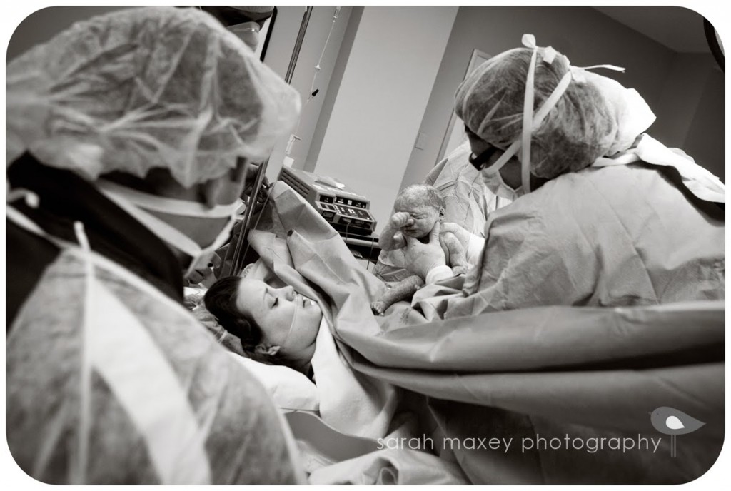 c-section birth photo