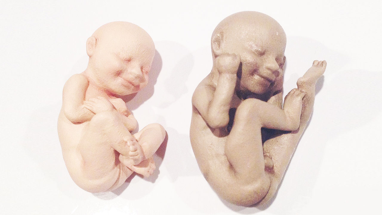 3D Unborn Baby