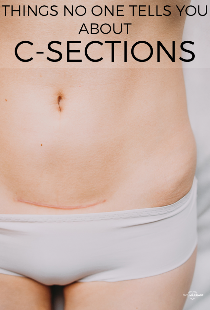 11 Things No One Tells You About C-Sections