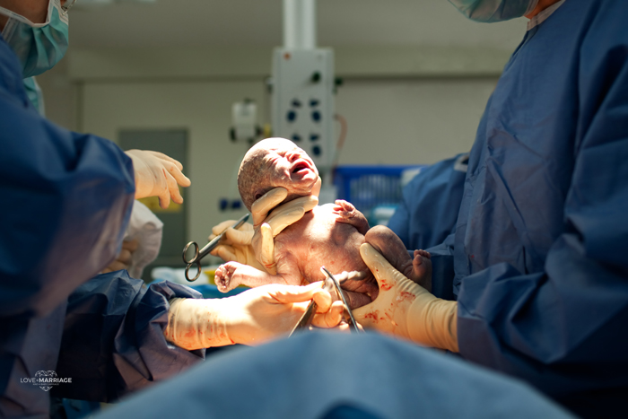 5 Reasons You Should NEVER Have A C-Section