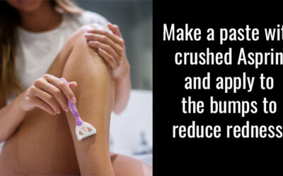 How To Get Rid of Razor Bumps